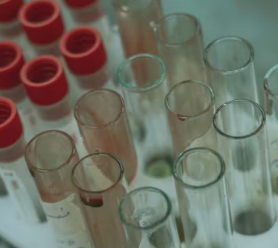 폐경기 전조증상 대처법