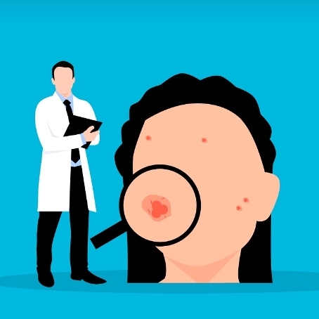 피부암 초기증상