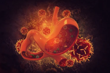 위암 초기평소증상