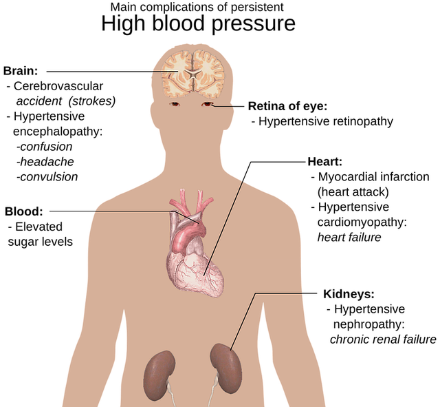 고혈압 낮추는 방법 총정리 32