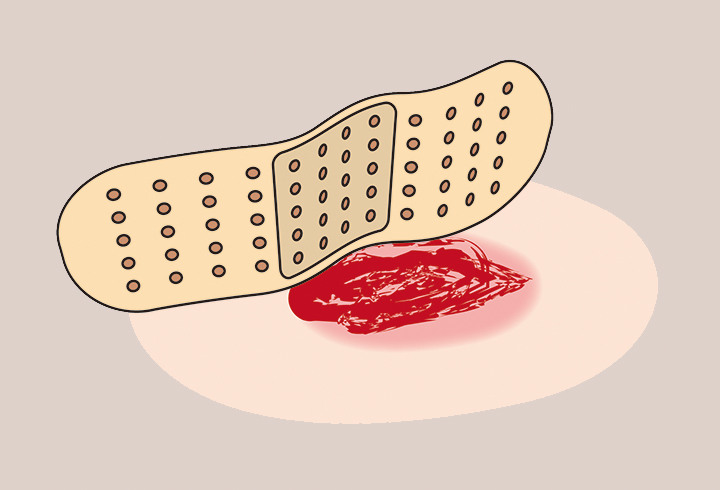 상처부위와-밴드