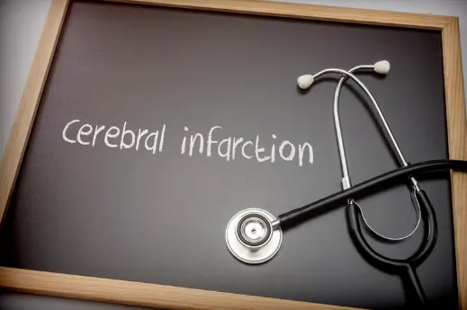뇌경색 초기증상&amp;#44; 원인 및 치료 방법