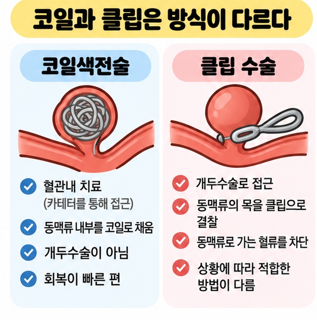 코일색전술의 혈관내 치료와 클립결찰술의 개두수술 방식을 비교한 카드