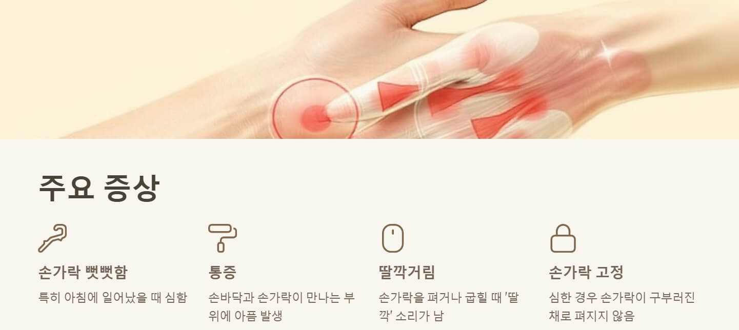 방아쇠 수지 증후근 원인 치료 수술