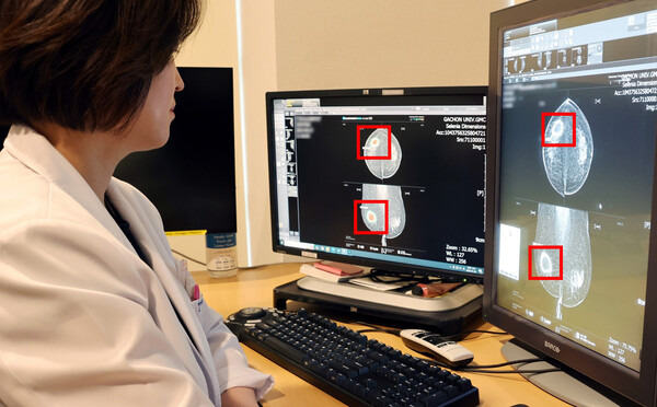25.01.23(목) 금일 핫한 의료AI 관련주 및 주요 종목 공시