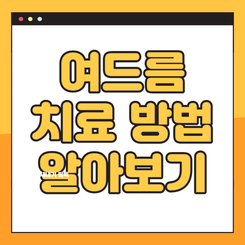 여드름 치료 방법