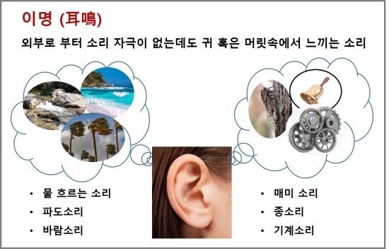 이명 원인
