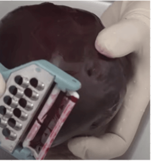 비트_먹는_방법