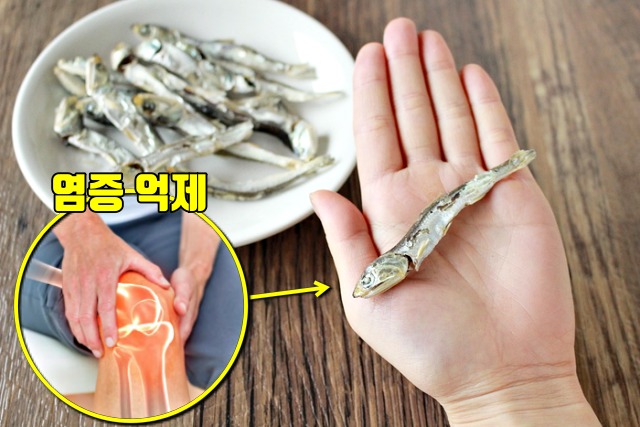 관절염에 좋은 음식 멸치 효능