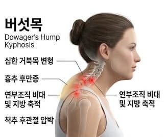 버섯목