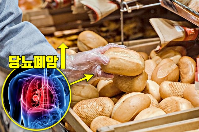 암이 좋아하는 음식,하얀 밀가루 암유발 음식