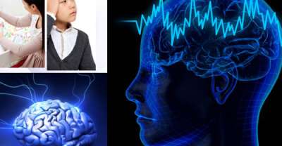 뇌전증 전조증상&amp;#44;원인