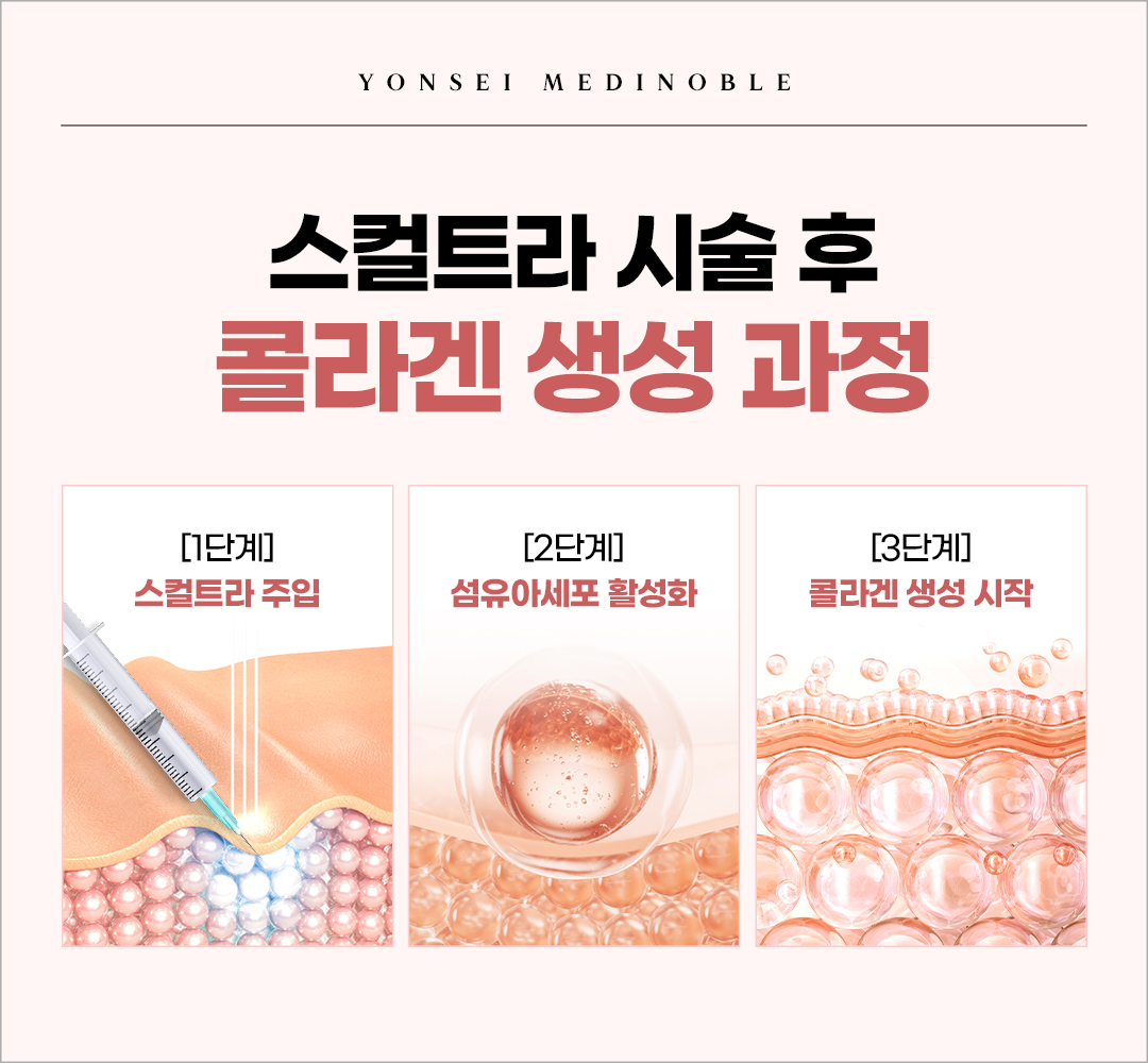 스컬트라 콜라겐 생성 과정