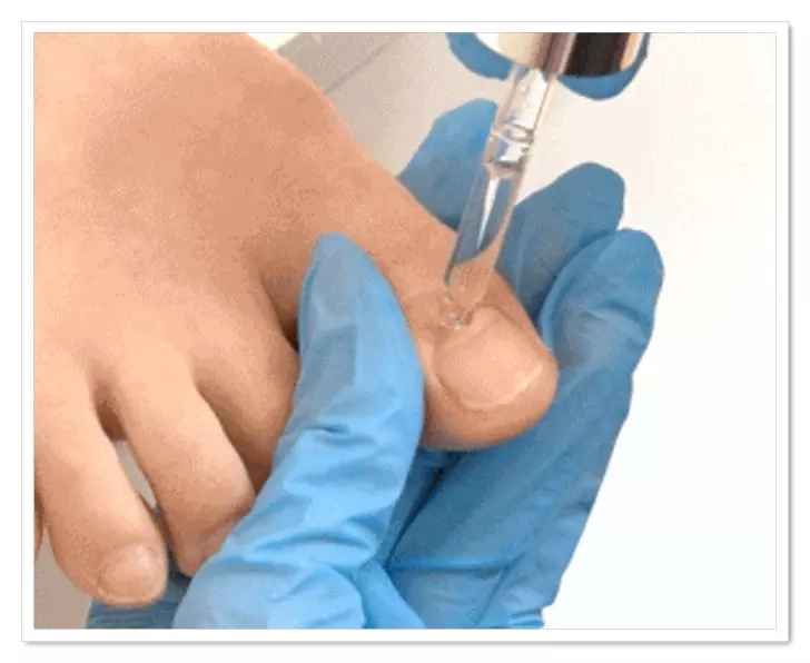 라셀턴 발톱세럼 사용법