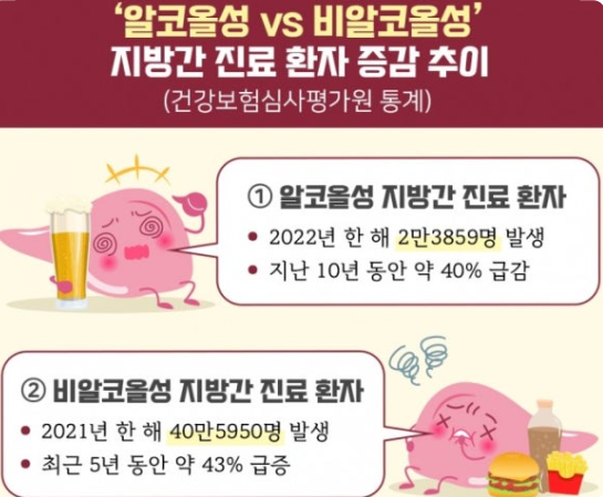 알코올성 간질환과 비알코올성 지방간 관련 사진