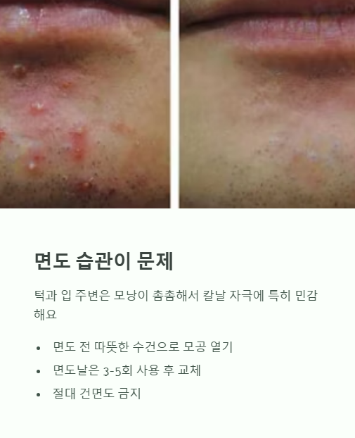 면도 습관이 문제