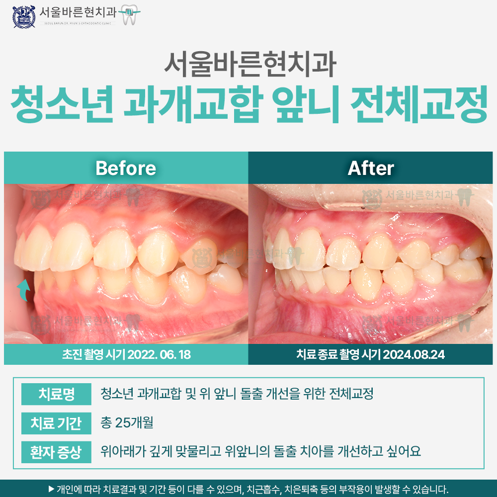 해운대교정치과