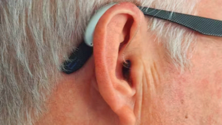 돌발성 난청 원인 