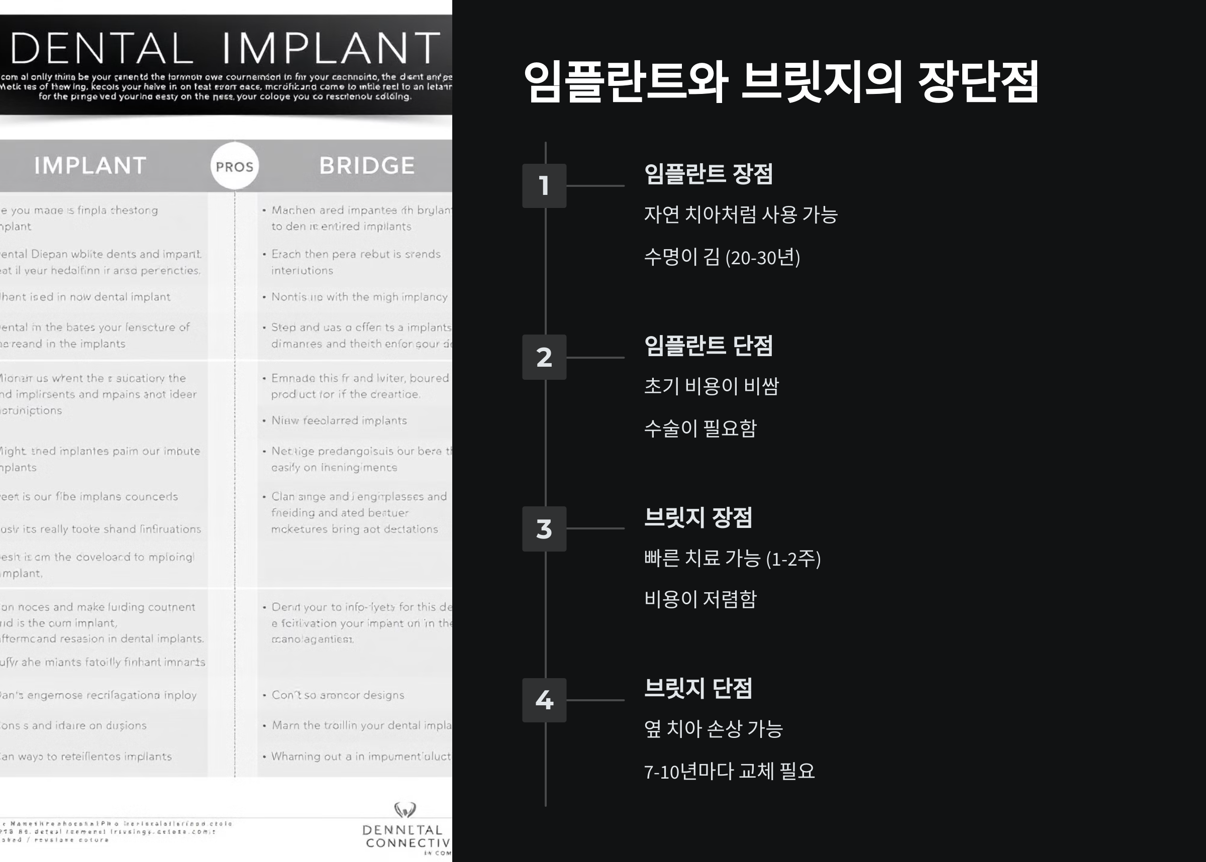 임플란트와 브릿지의 장단점