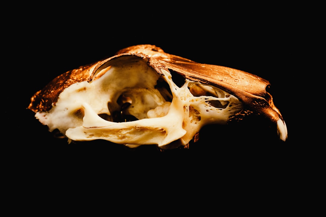 Bronchus