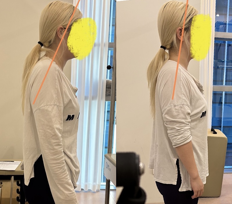 송도 재활 필라테스, 어디서 받아야 할까? 전문가가 알려주는 선택 기준