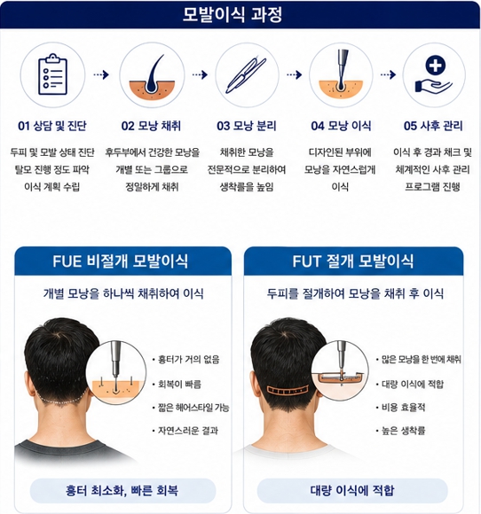 원형탈모이미지