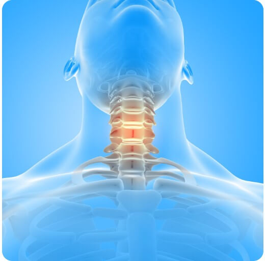 갑상선암을 설명하는 분석 자료