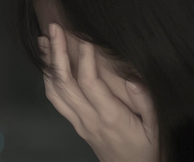 보톡스 부작용에 힘들어하는 사진
