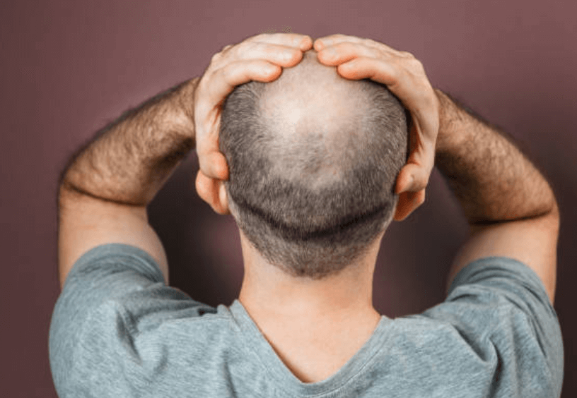 머리카락 빨리 자라게 하는 방법