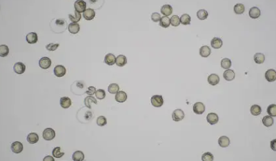 입술에 물집이 생기는 이유 5