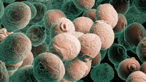 칸디다증 칸디다 감염 칸디다 치료 칸디다 증상 부위별 키워드 구강 칸디다증 (아구창) 질 칸디다증 피부 칸디다 식도 칸디다 칸디다 골관절염 칸디다 복막염 간비장 칸디다증 원인 및 치료 관련 키워드 칸디다증 원인 칸디다 감염 원인 칸디다증 치료법 칸디다 연고 칸디다 항진균제 칸디다증 면역력 강화 예방 및 생활습관 키워드 칸디다증 예방 칸디다에 좋은 음식 칸디다에 좋은 습관 항생제 부작용 칸디다 음식 관련 키워드 칸디다증에 좋은 음식 칸디다 억제 식품 마늘 칸디다 억제 칸디다 녹황색 채소 오메가3 칸디다 기타 연관 키워드 칸디다 전염성 칸디다증 생활 습관 칸디다증 자가진단 칸디다 곰팡이 감염 칸디다증 면역력