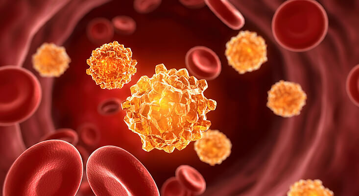 혈당스파이크 증상