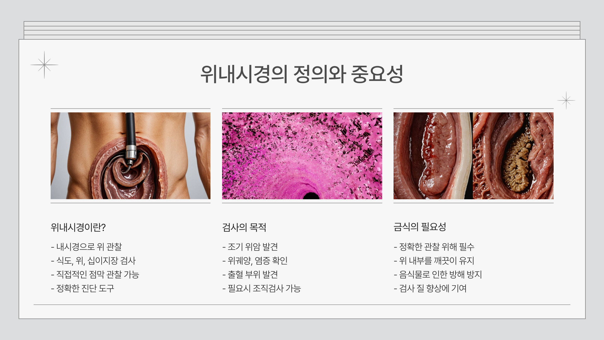 위내시경 금식시간