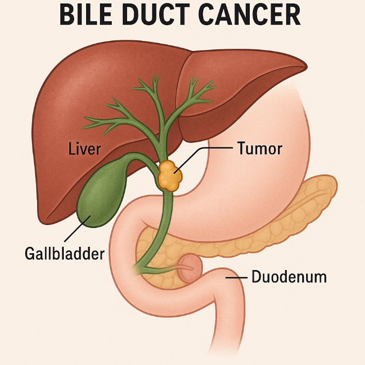 담도암 관련 자료 사진