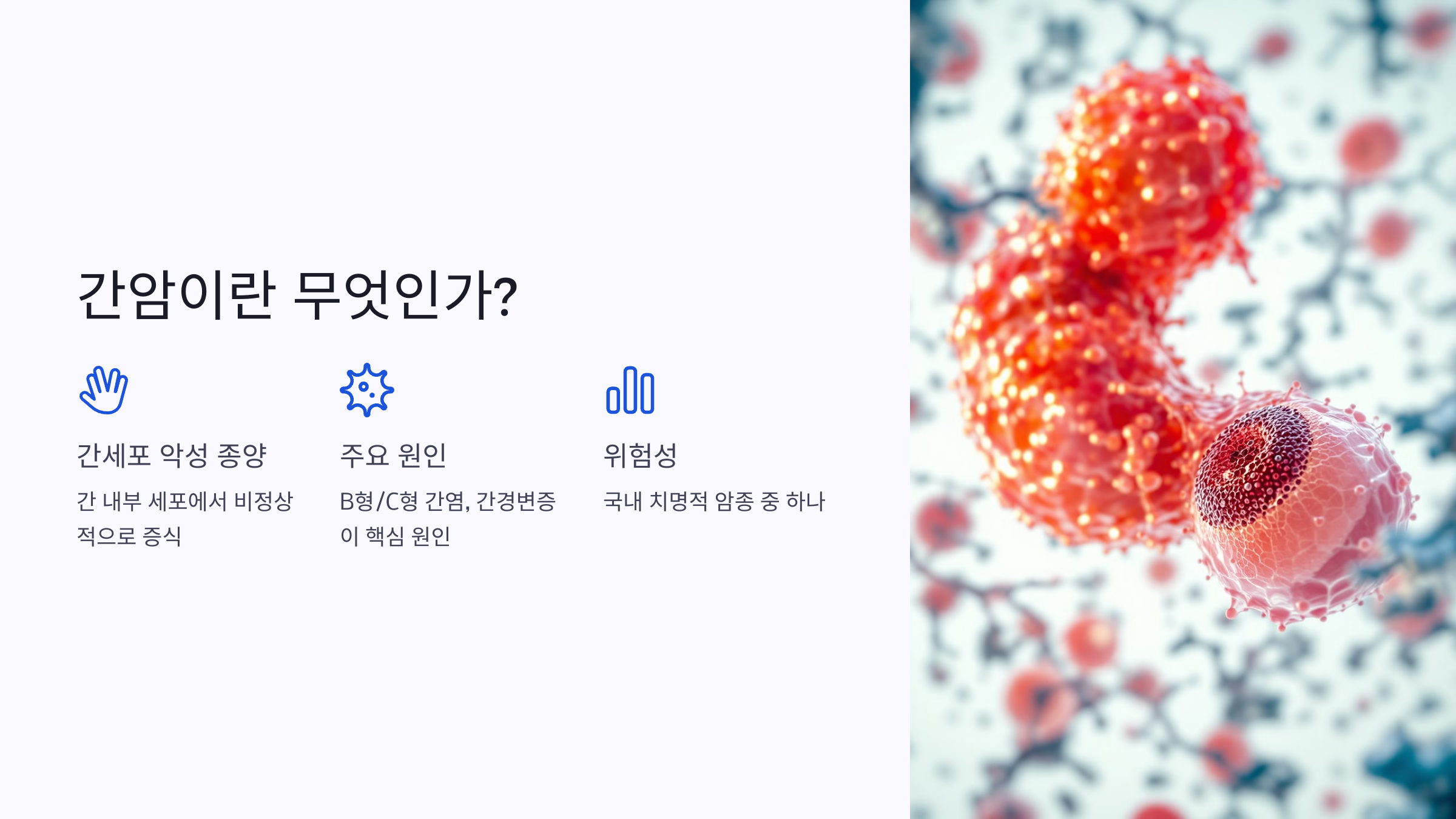 간암이란 정확히 어떤 병일까?
