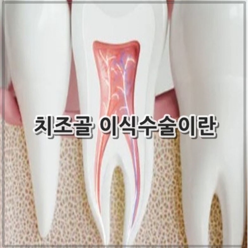치조골 이식수술이란