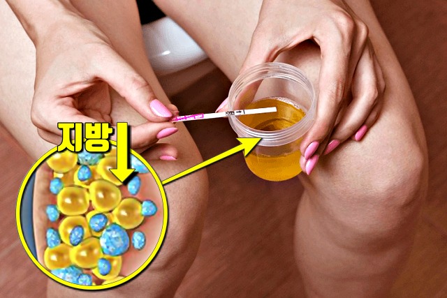 소변에서 냄새가 나는 이유 다이어트, 건강 팁줌