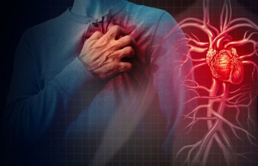 심장질환
