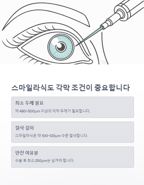 스마일 라식도 각막 조건이 중요 합니다