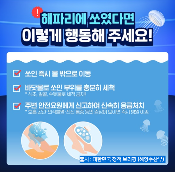 노무라입깃해파리 응급처치 방법 이미지