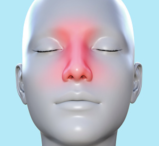 코피가 자주나는 이유 18