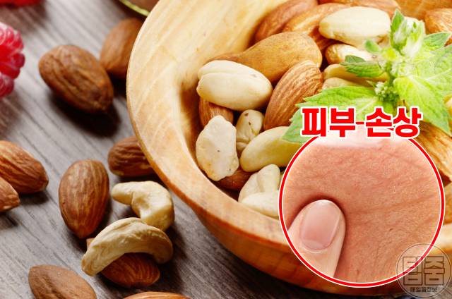 보습에 좋은 음식,보습에 좋은 성분 비타민e,건조한 피부 관리법