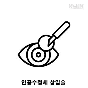 백내장 증상 원인