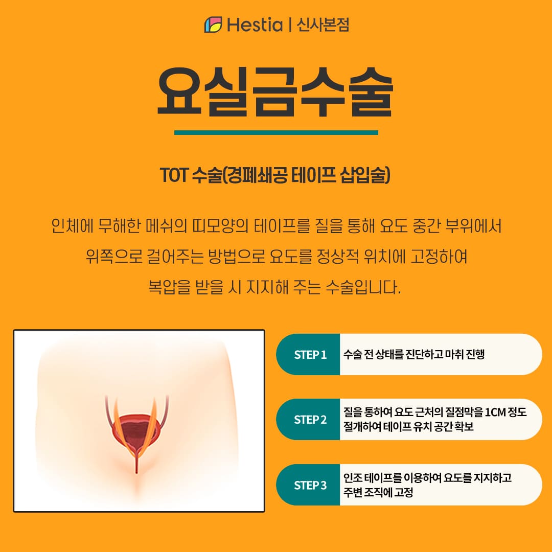 요실금수술이란?