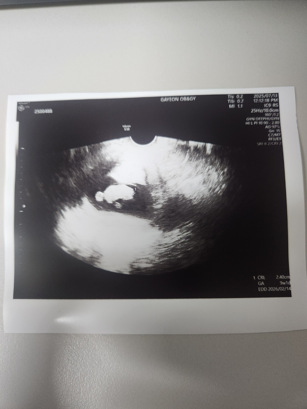 임신9주차, 9주1일차 초음파 젤리곰 난황