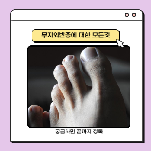 발 사진