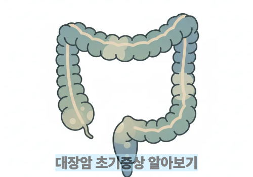 대장암 초기증상