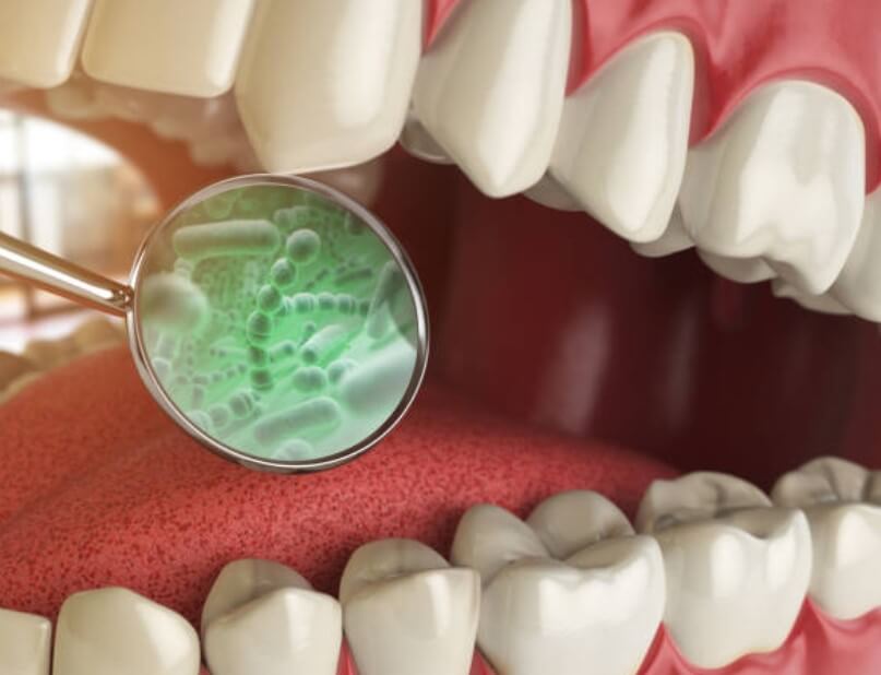 입냄새 심한이유 입냄새 심한 이유 입냄새 제거방법 입냄새 원인 입냄새 맡는방법