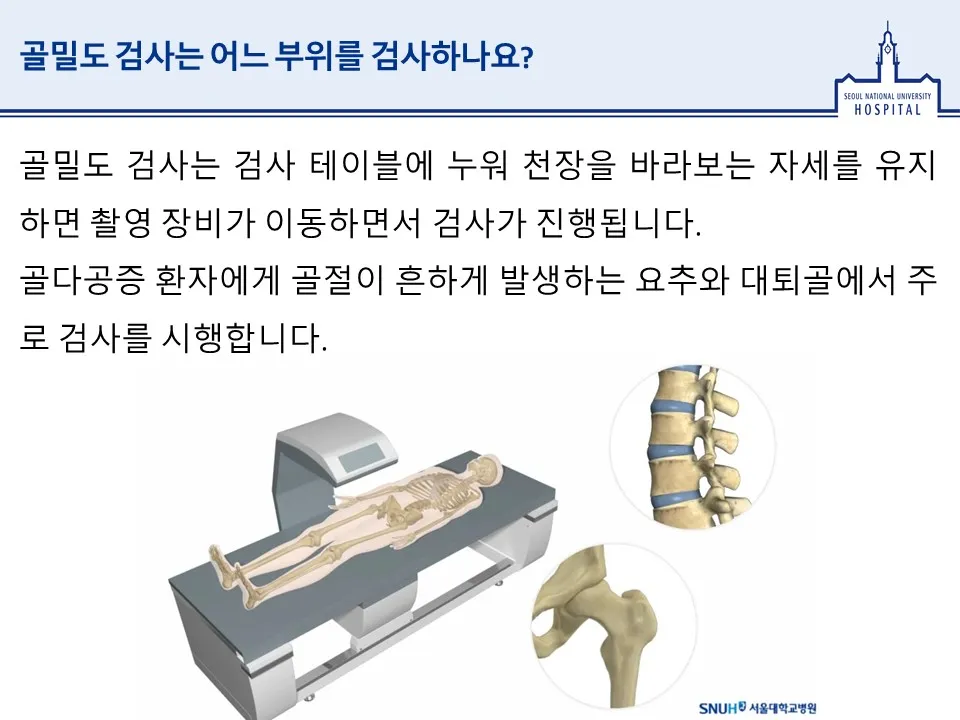 골밀도 검사 수치 골밀도 높이는 방법 간단 정리_2