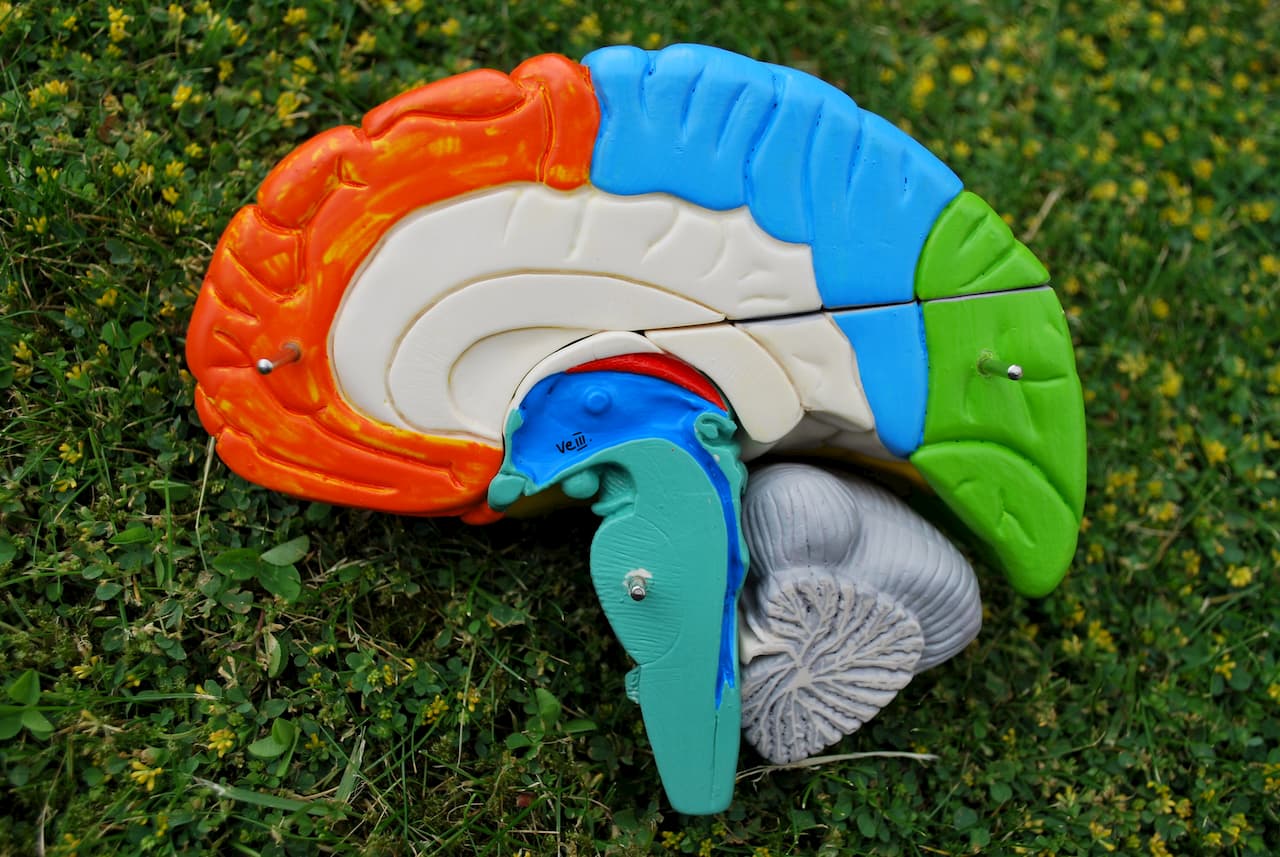 모야모야 병 뇌 구조